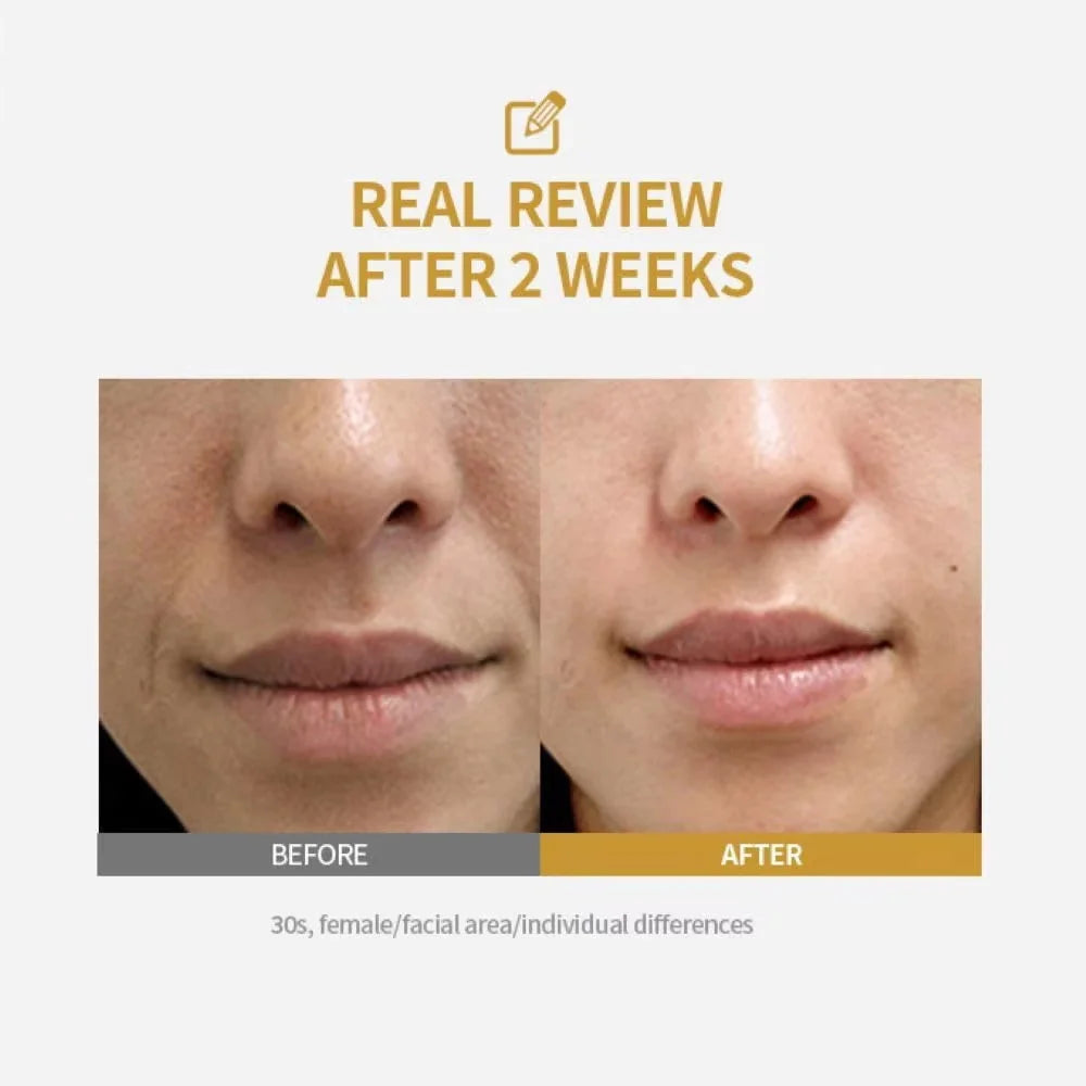 Peptide Intensive Lifting Ampoule Deep Collagen Face Firming Moisturizing Serum Glass Skin Tightening Hydration Korean Skincare
